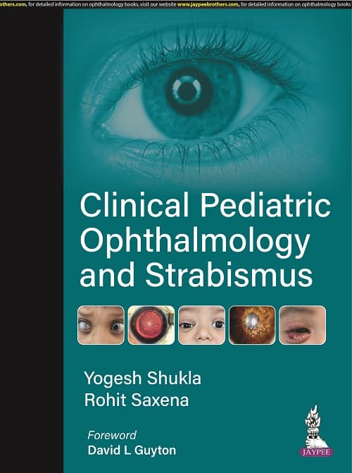 Clinical Pediatric Ophthalmology And Strabismus 1st/2022