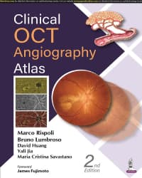Clinical OCT Angiography Atlas 2nd/2022