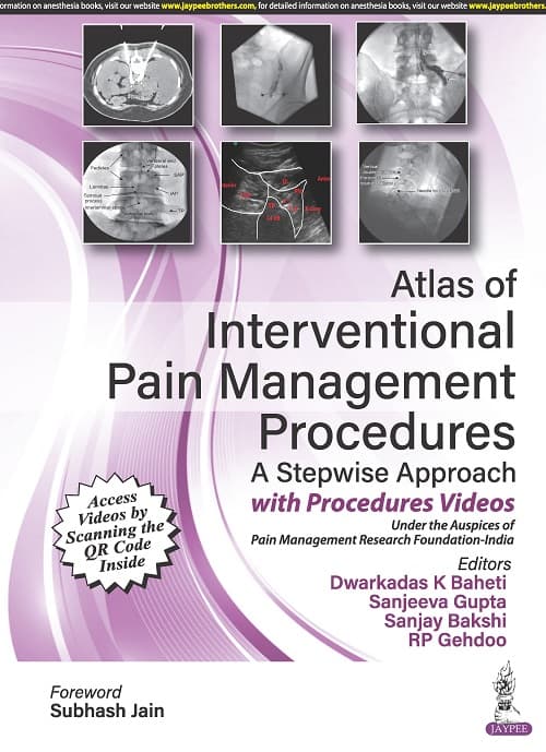 Atlas of Interventional Pain Management Procedures 1st/2023