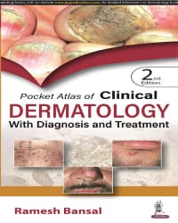Pocket Atlas of Clinical Dermatology with Diagnosis and Treatment 2nd/2023