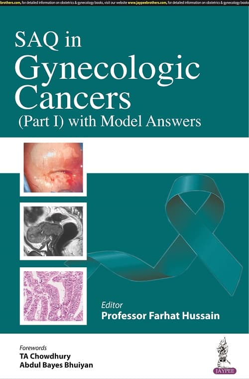 SAQ in Gynecologic Cancers 1st/2022