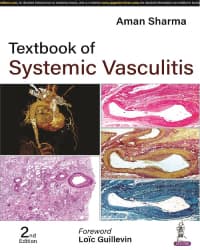 Textbook of Systemic Vasculitis 2nd/2023