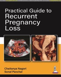 Practical Guide to Recurrent Pregnancy Loss 1st/2023