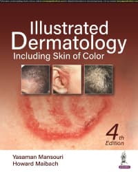 Illustrated Dermatology Including Skin of Color 4th/2023