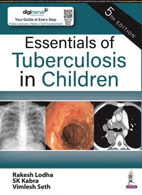 Essentials of Tuberculosis in Children 5th/2023