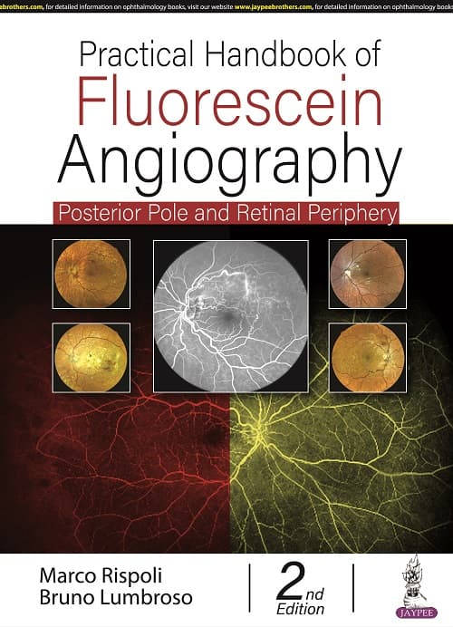 Practical Handbook of Fluorescein Angiography 2nd/2022