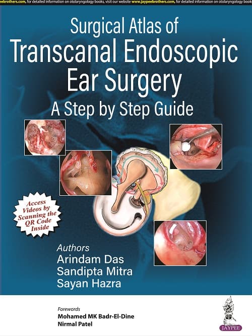 Surgical Atlas of Transcanal Endoscopic Ear Surgery 1st/2023