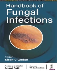 Handbook of Fungal Infections 1st/2023