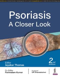 Psoriasis A Closer Look 2nd/2023