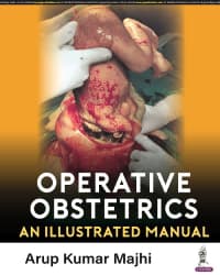 Operative Obstetrics An Illustrated Manual 1st/2023