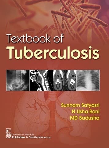 Textbook Of Tuberculosis 1st/2022