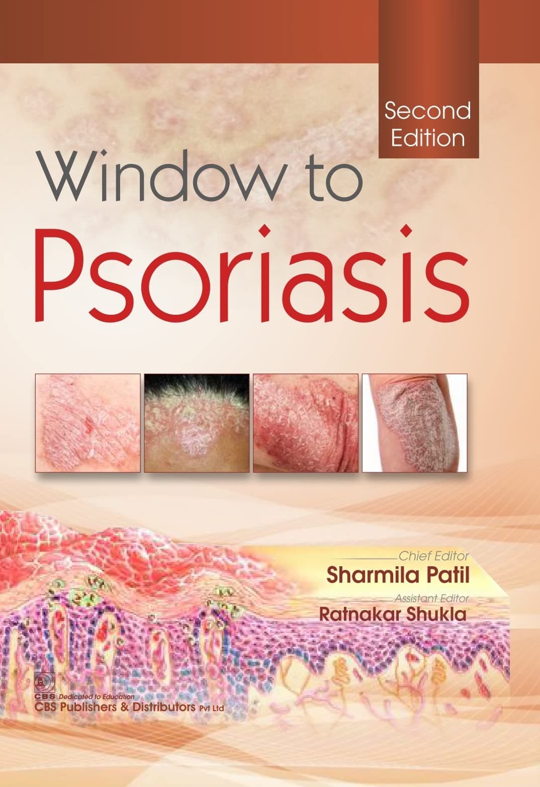 Window to Psoriasis 2nd/2022