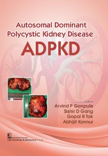 Autosomal Dominant Polycystic Kidney Disease (ADPKD) 1st/2022