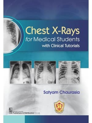 Chest X-Rays for Medical Students with Clinical Tutorials  1st/2023