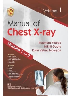Manual of Chest X-ray 1st/2024 (Vol 1)