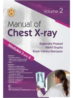 Manual of Chest X-ray 1st/2024 (Vol 2)