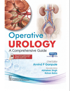 Operative Urology A Comprehensive Guide 1st/2024