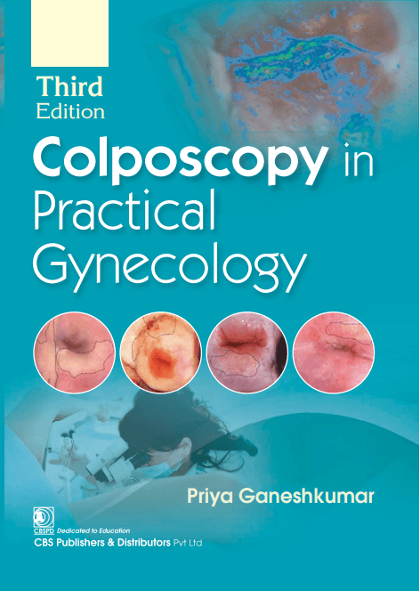 Colposcopy in Practical Gynecology 3rd/2025