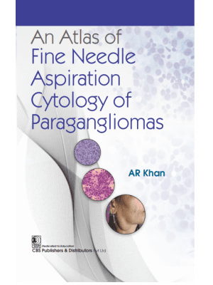 An Atlas of Fine Needle Aspiration Cytology of Paragangliomas 1st/2024