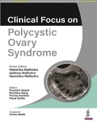 Clinical Focus on Polycystic Ovary Syndrome 1st/2023