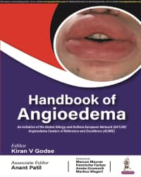 Handbook of Angioedema 1st/2024