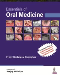 Essentials of Oral Medicine 1st/2024
