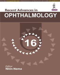 Recent Advances in Ophthalmology 16 1st/2023