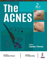 The Acnes 2nd/2024