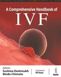 Comprehensive Handbook of IVF 1st/2024
