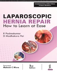 Laparoscopic Hernia Repair: How to Learn at Ease 2nd/2024