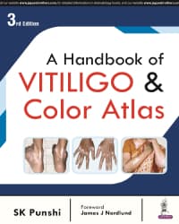 Handbook of Vitiligo & Color Atlas 3rd/2024