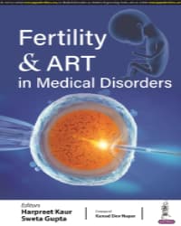 Fertility and ART in Medical Disorders 1st/2024