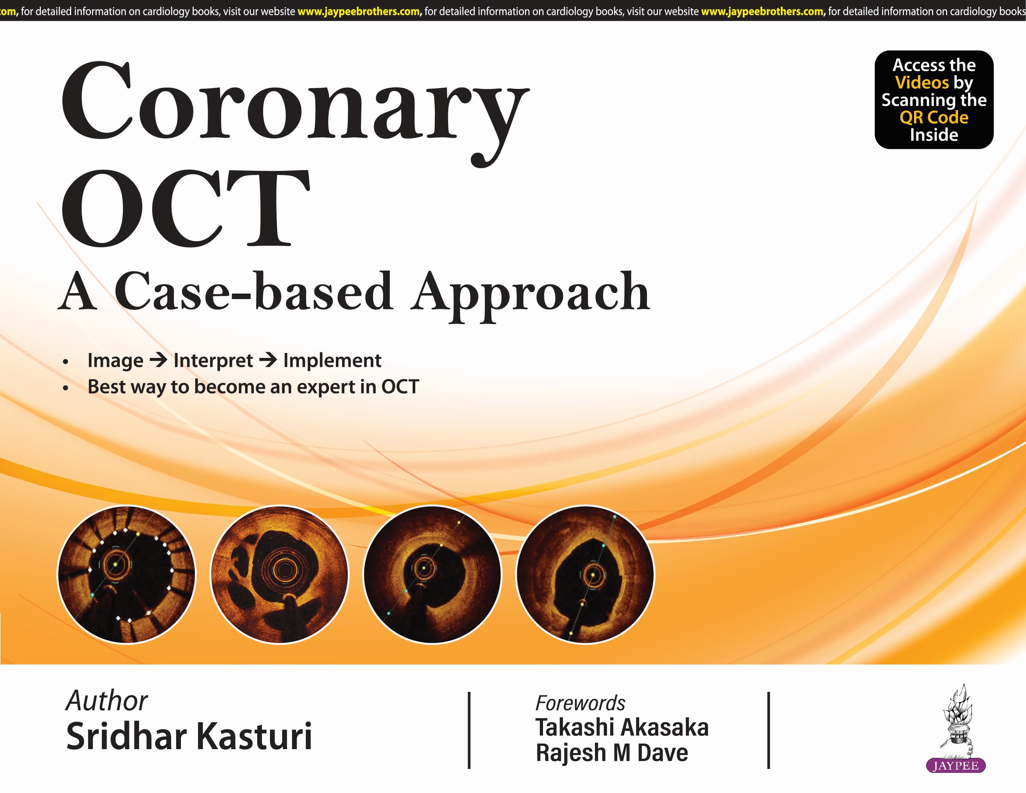 Coronary OCT A Case Based Approach 1st/2024