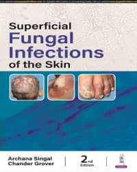 Superficial Fungal Infections of the Skin 2nd/2024