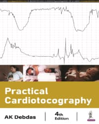 Practical Cardiotocography 4th/2024