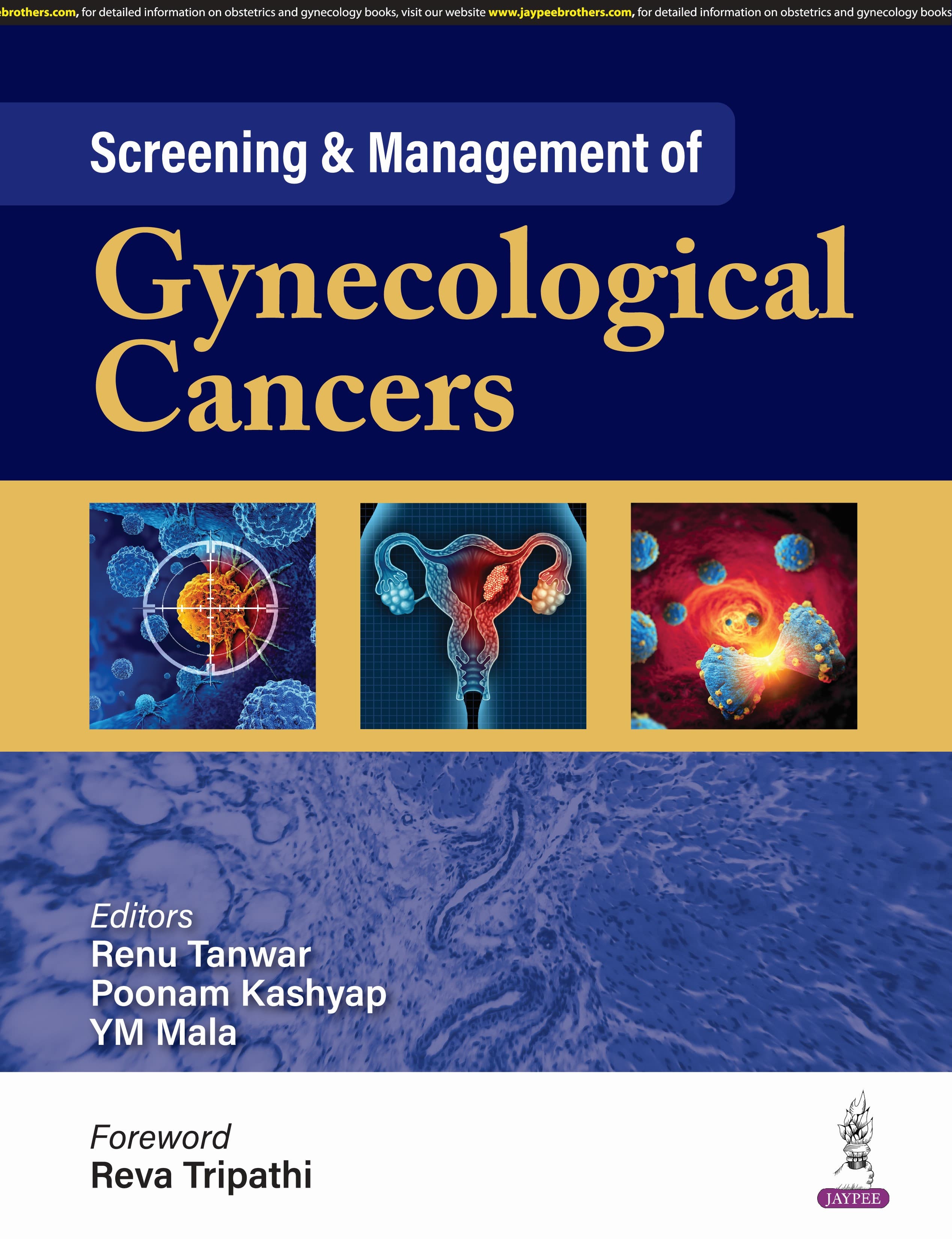 Screening and Management of Gynecological Cancers 1st/2025