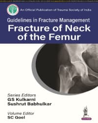 Guidelines in Fracture Management Fracture of Neck of the Femur 1st/2024