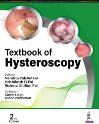 Textbook of Hysteroscopy 2nd/2024