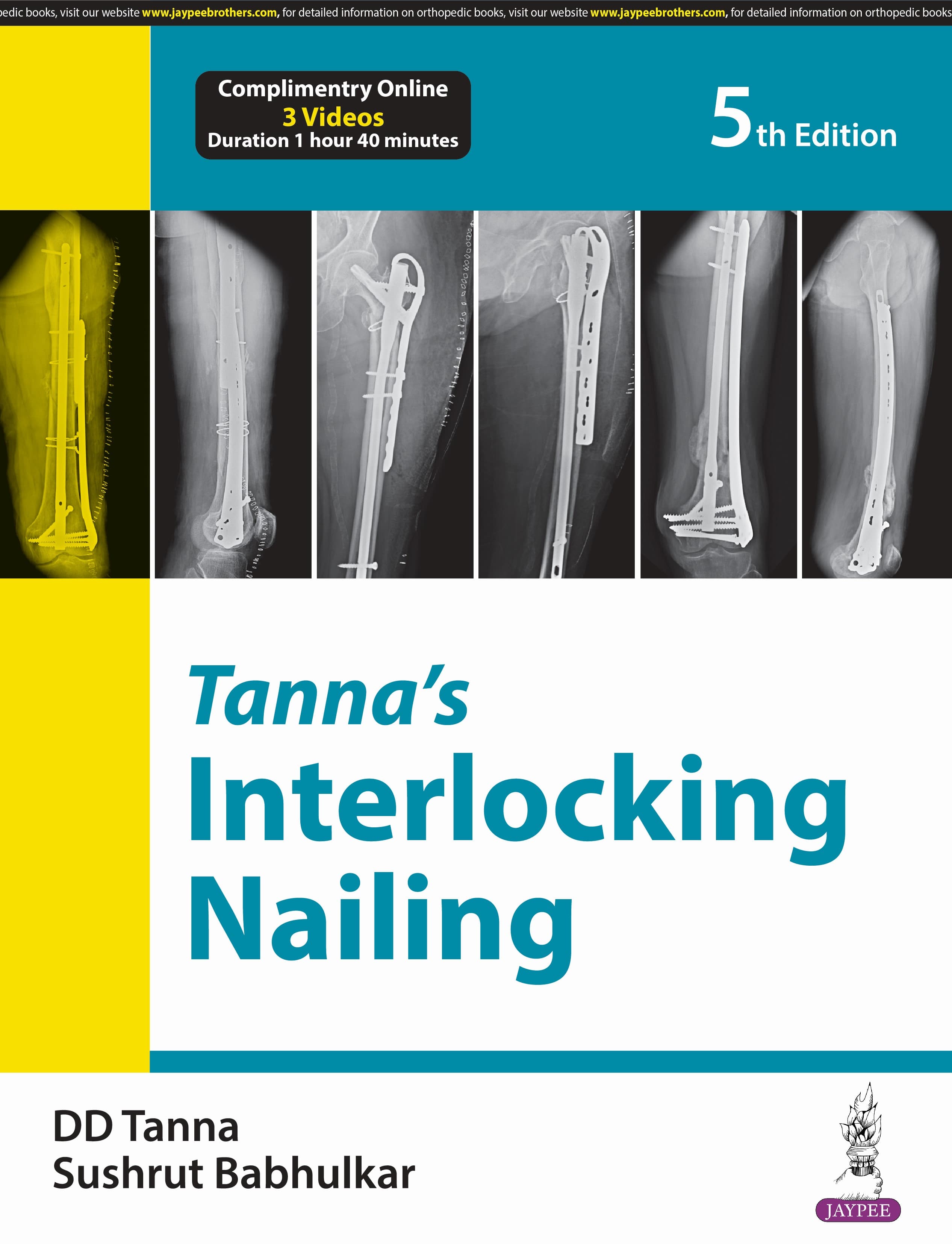 Tanna's Interlocking Nailing 5th/2024