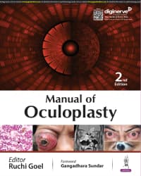 Manual of Oculoplasty 2nd/2024