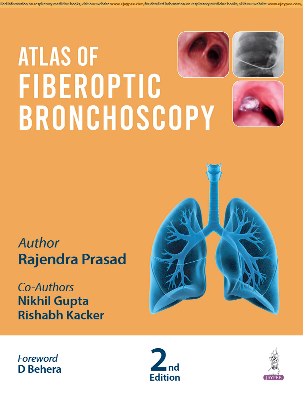 Atlas of Fiberoptic Bronchoscopy 2nd/2026