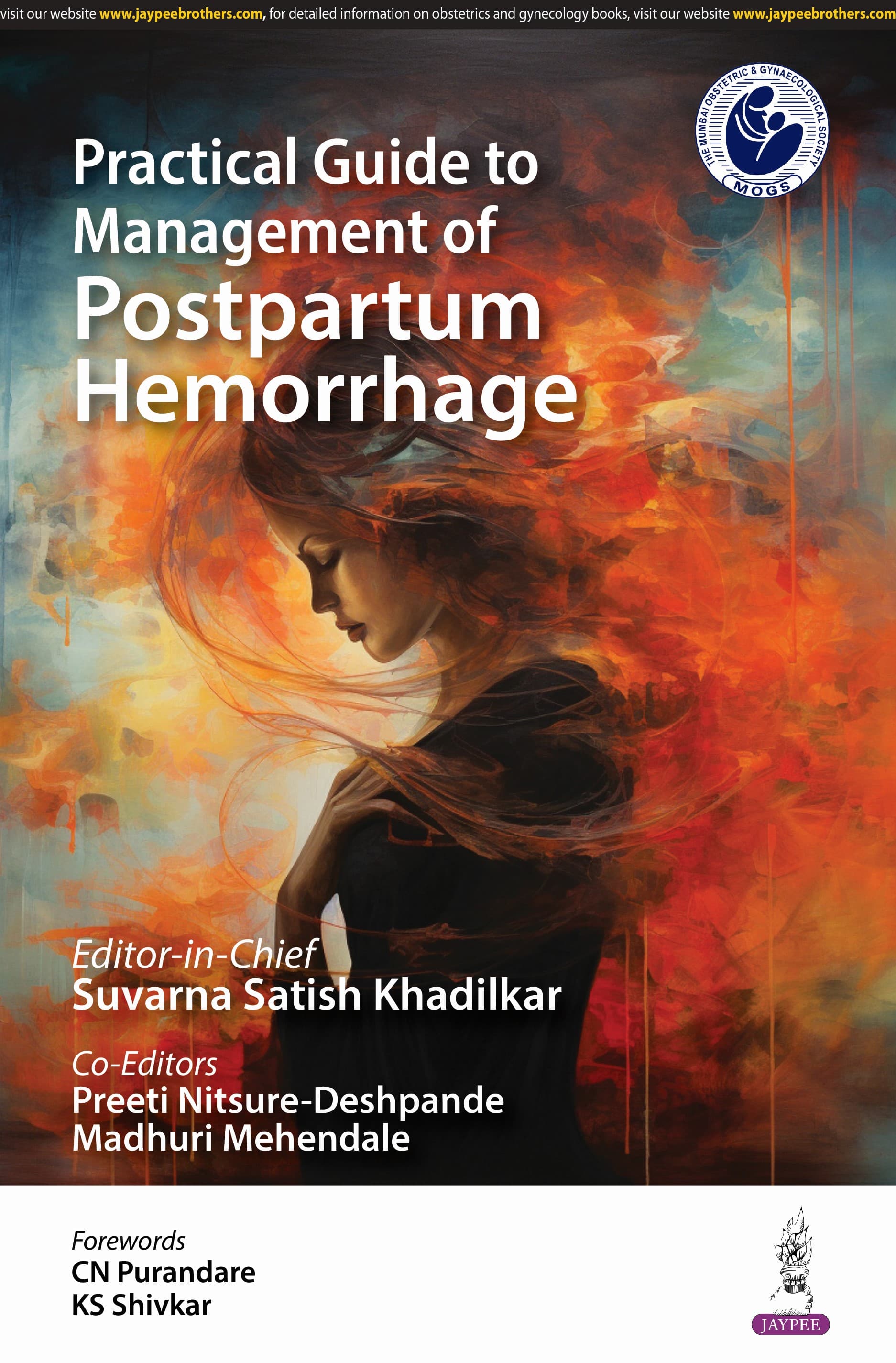 Practical Guide to Management of Postpartum Hemorrhage 1st/2025