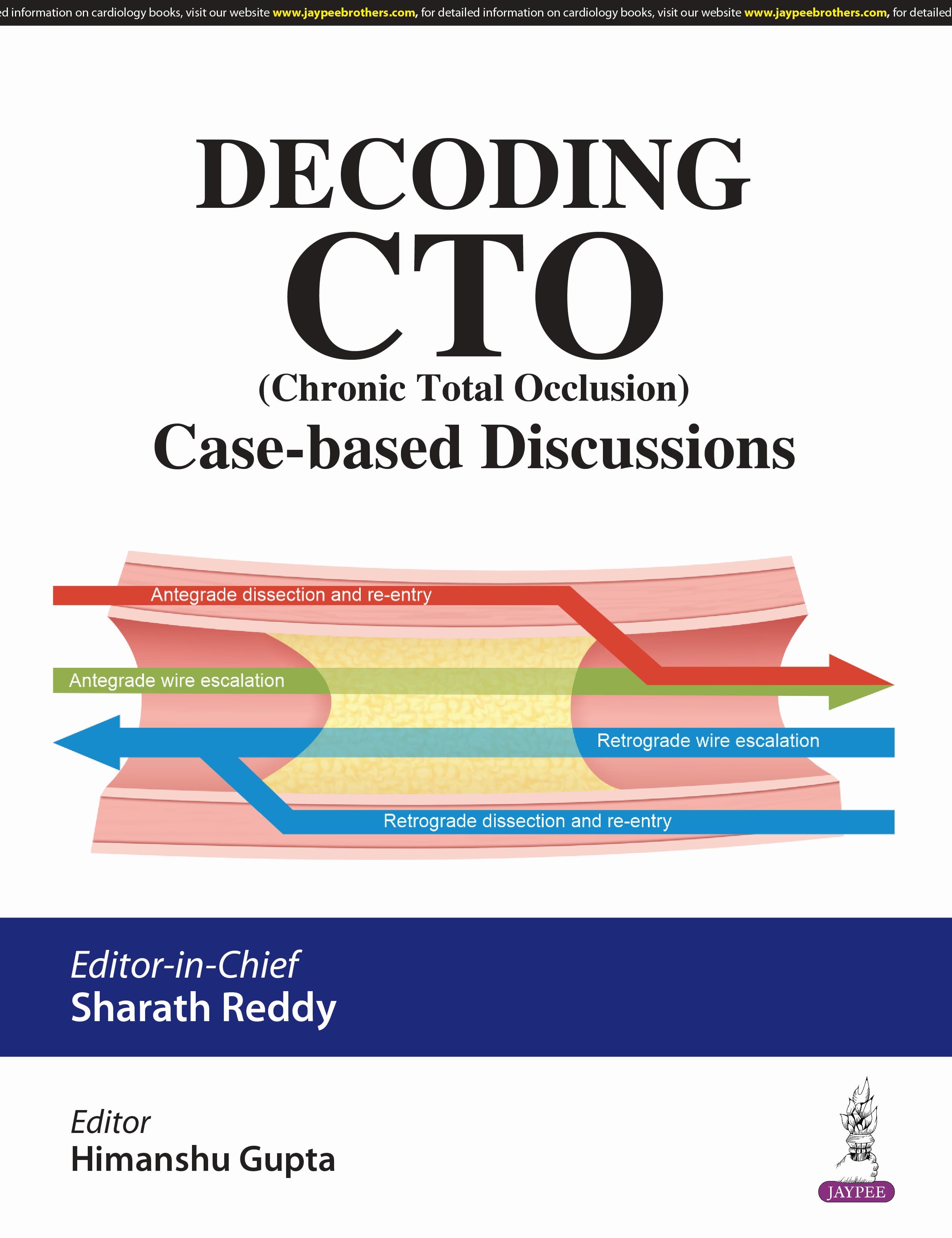 Decoding CTO (Chronic Total Occlusion) Case Based Discussions 1st/2025