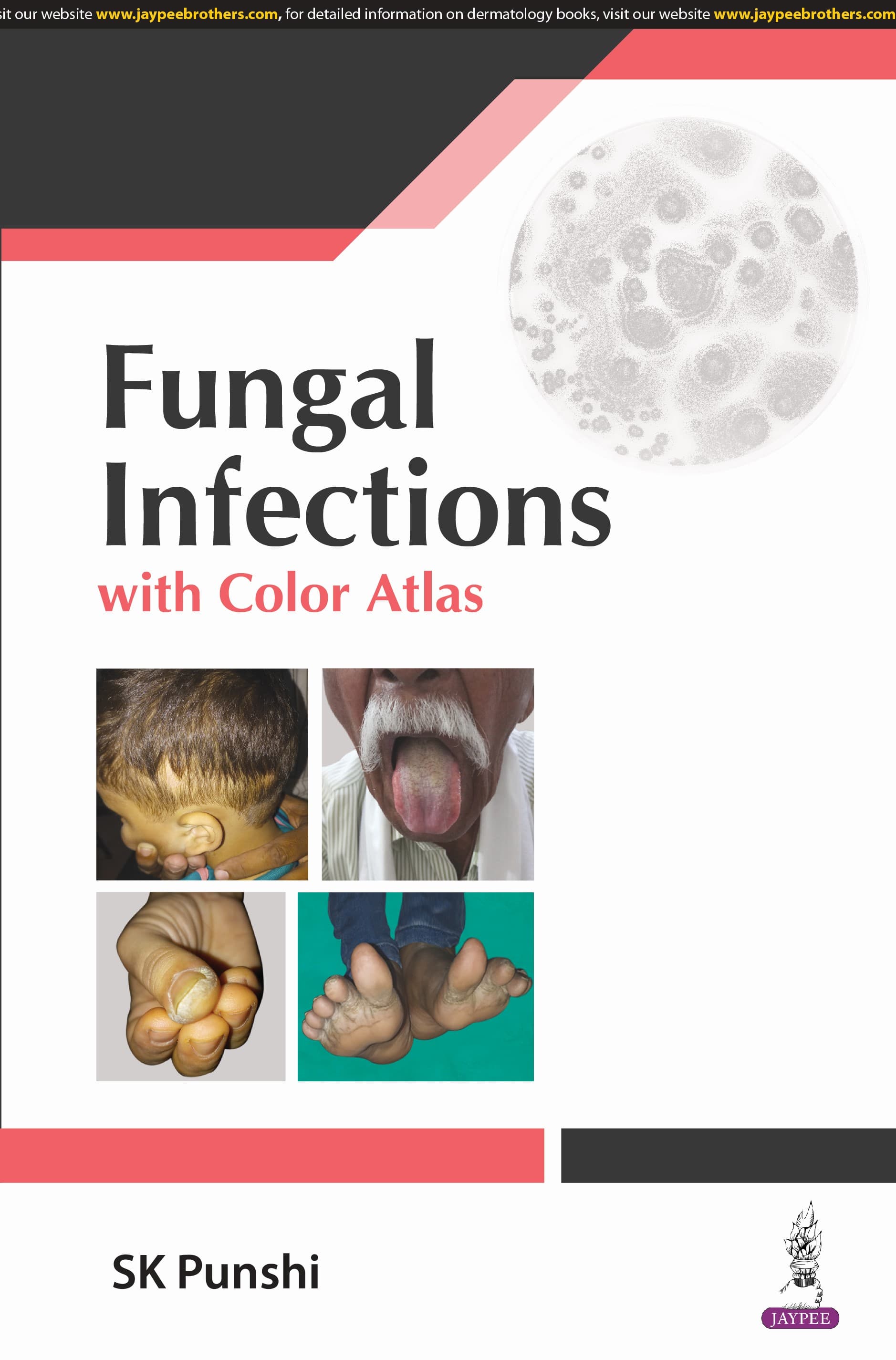 Fungal infections with Color Atlas 1st/2024