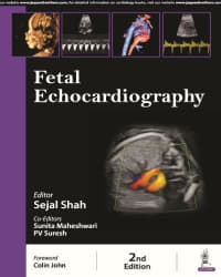 Fetal Echocardiography 2nd/2024