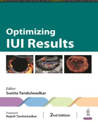 Optimizing IUI Results 2nd/2024
