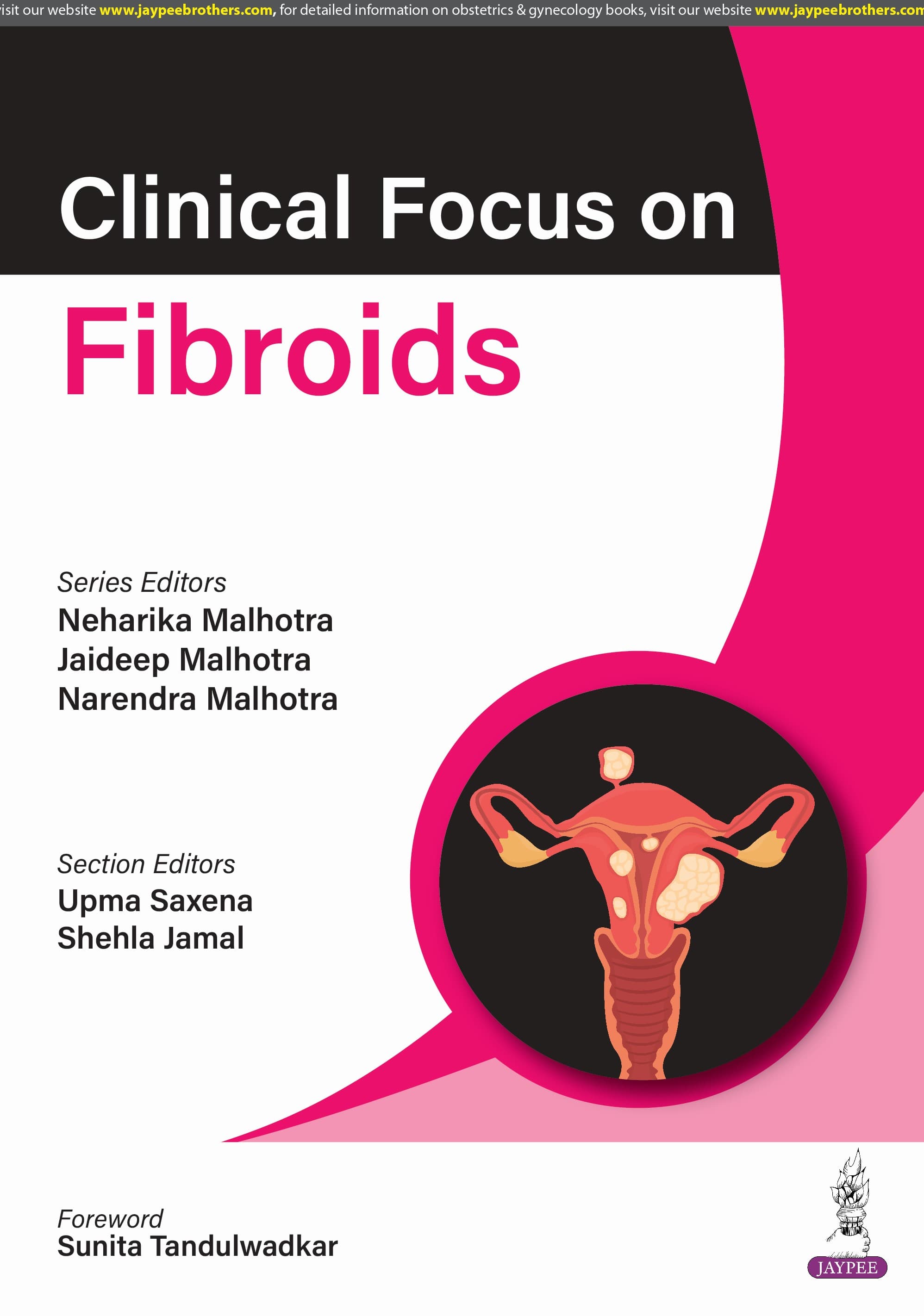 Clinical Focus on Fibroids 1st/2025
