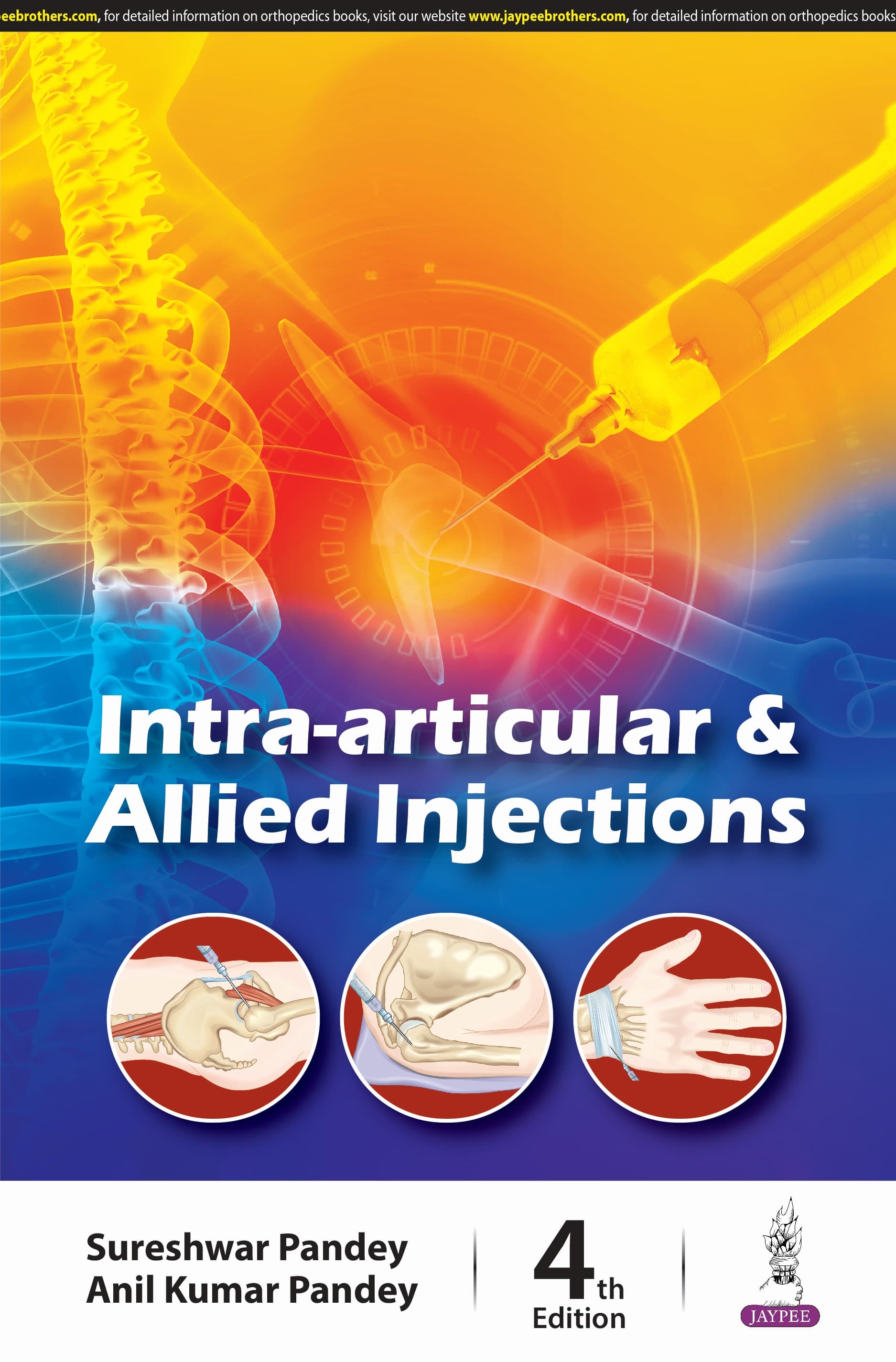 Intra Articular and Allied Injections 4th/2025