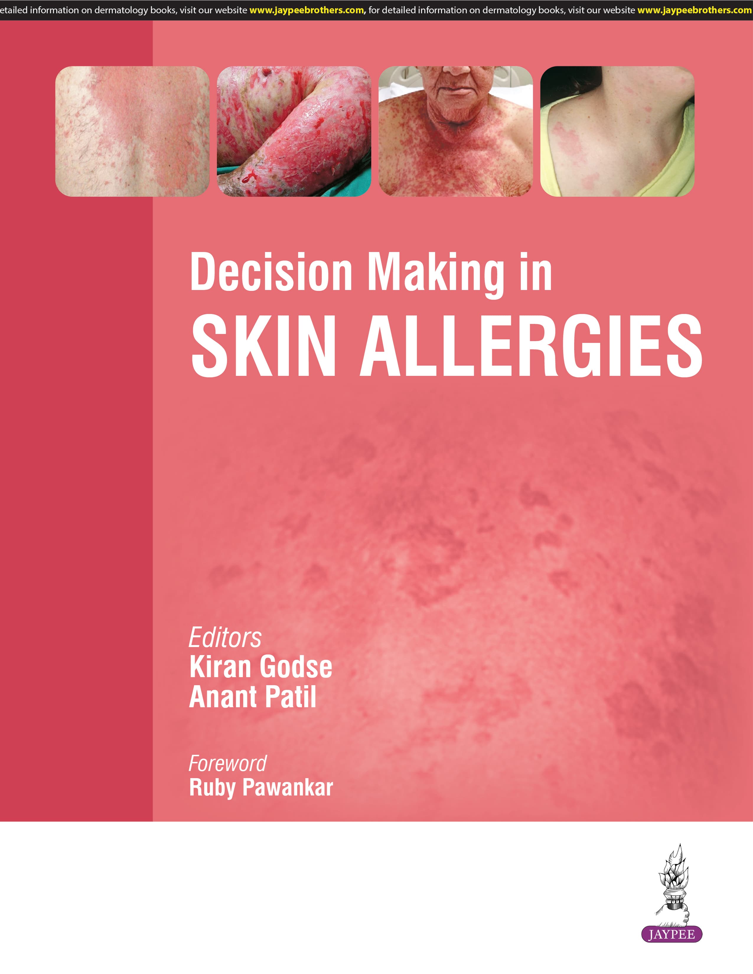 Decision Making in Skin Allergies 1st/2025