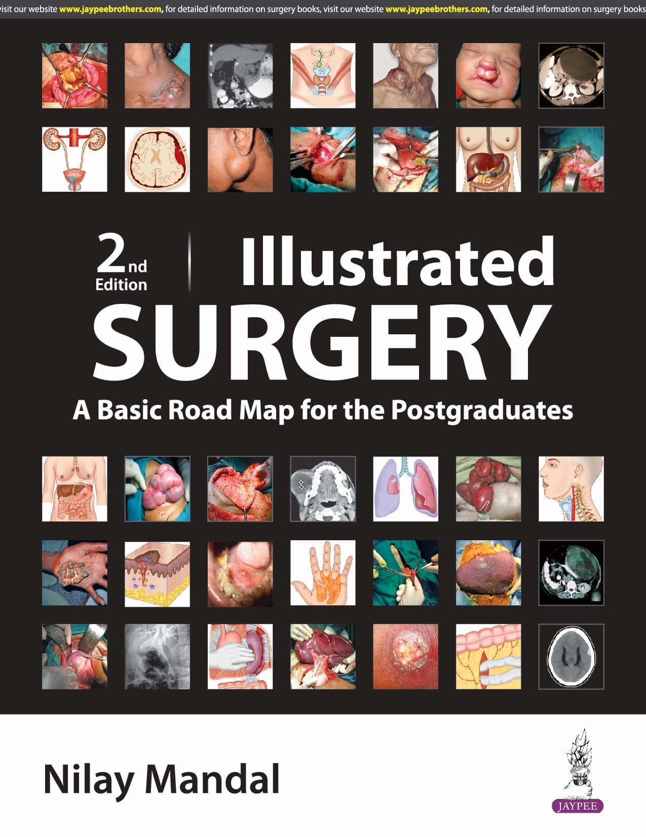 Illustrated Surgery 2nd/2024